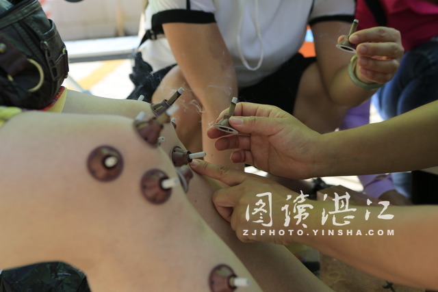 艾灸志愿者培训,艾灸公益活动方案