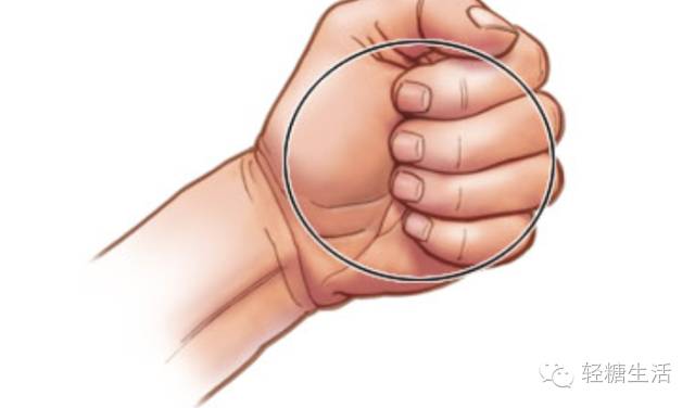 针对糖尿病人的膳食指南包括,糖尿病饮食指南食谱量表