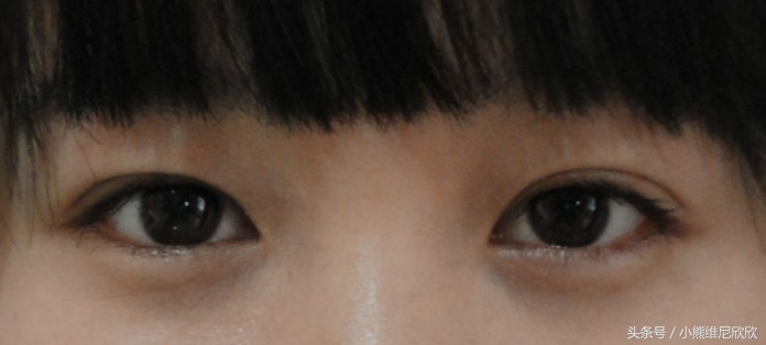 多层眼皮属于什么眼型,眼皮怎么分眼型