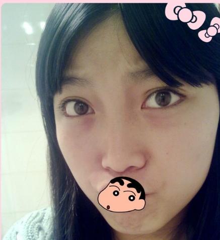 为什么有些人天生眼袋那么严重,为什么有人天生有眼袋