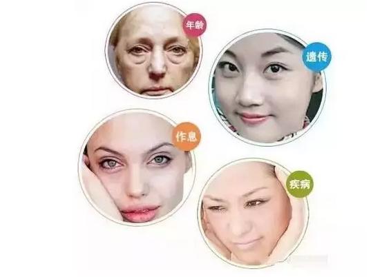 眼袋是什么原因引起的怎样消除,眼袋是怎么导致的有了眼袋怎么办