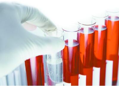 怀孕多长时间检查结果最精确,怀孕多久做检查能看孩子智力