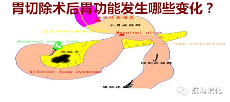 鑳冨垏闄ゆ伅鑲夊悗12灏忔椂楗,鑳冭偁鎭倝鍒囬櫎鍚庝竴鍛ㄥ悗楗