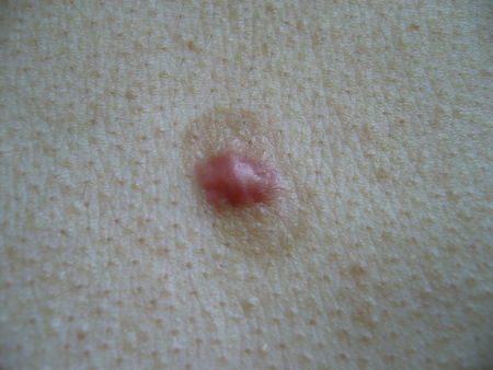 十元以下的常用药有什么,7种好用不贵的药家中可常备