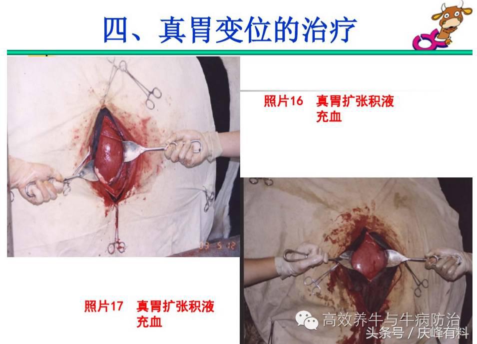 奶牛真胃扩张的症状治疗方法,奶牛皱胃左方变位治疗方法