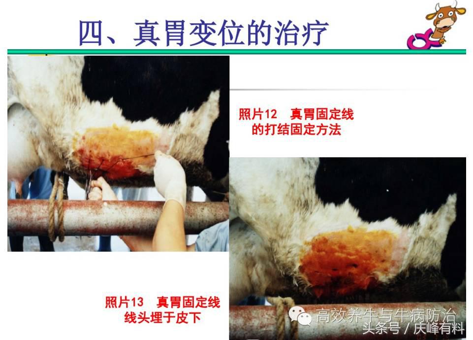 奶牛真胃扩张的症状治疗方法,奶牛皱胃左方变位治疗方法