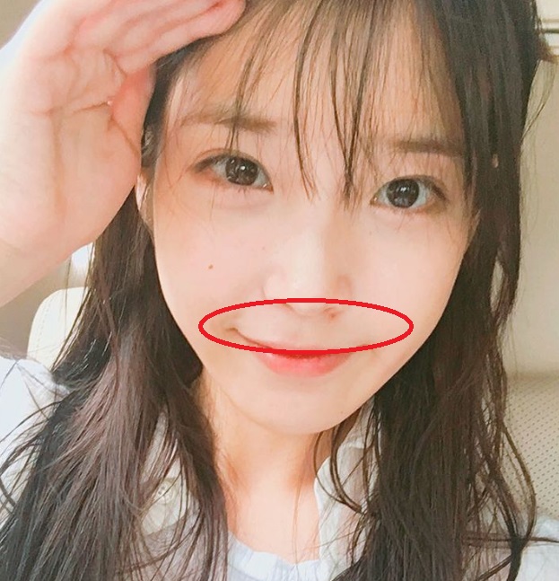 脸部不同部位痘痘代表什么,不同的痘痘要用不同的方法处理