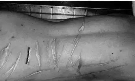 人死后有诈尸的吗,慈禧太后死后诈尸是真的吗