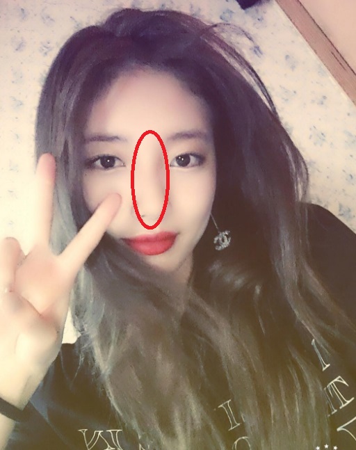 脸部不同部位痘痘代表什么,不同的痘痘要用不同的方法处理