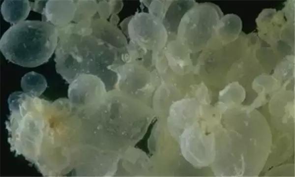 孕晚期b超数据比上次变小了,下腹部很大像怀孕一样