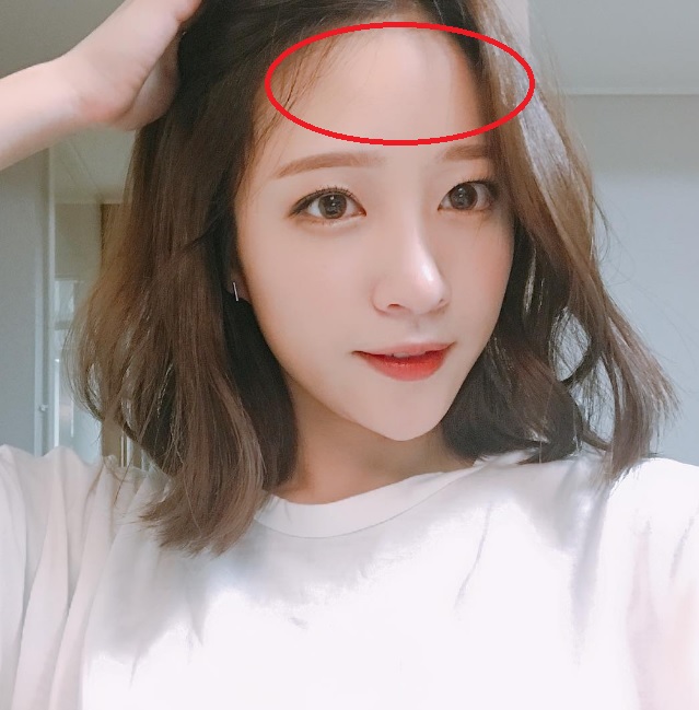 脸部不同部位痘痘代表什么,不同的痘痘要用不同的方法处理