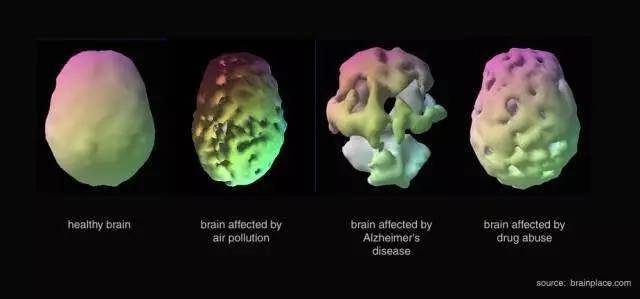 儿童顽固性咳嗽专家,雾霾天气孩子咳得厉害怎么弄