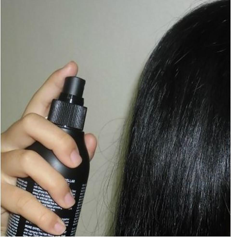 头皮痒怎么办最快最有效的方法,头皮痒什么原因怎么解决