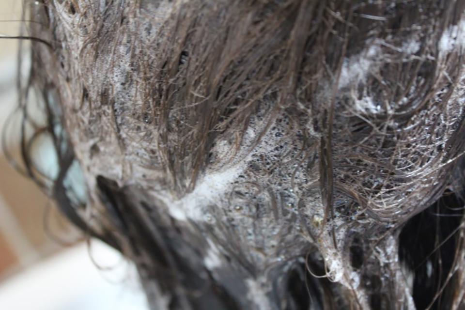 头皮痒怎么办最快最有效的方法,头皮痒什么原因怎么解决