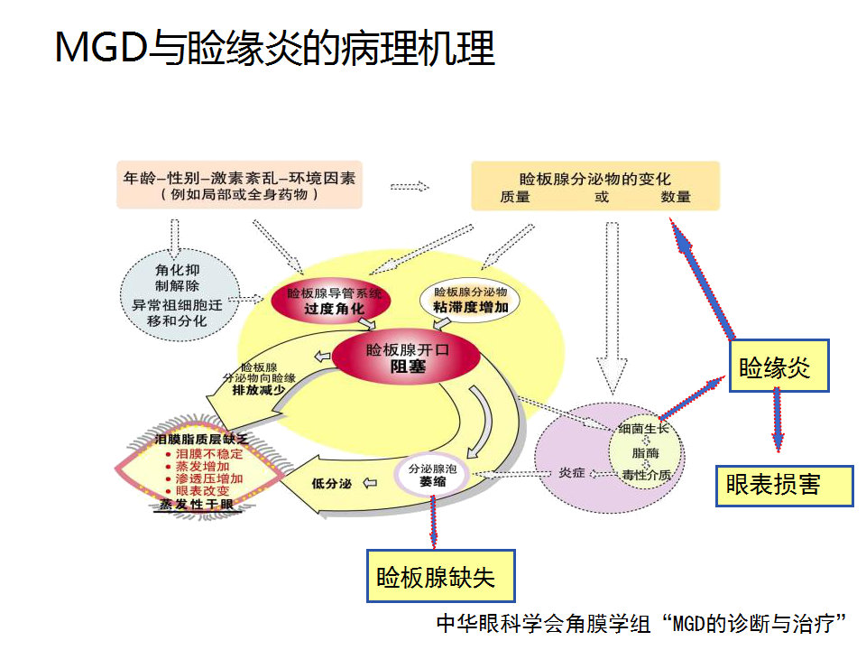 眼睑缘炎的发病原因,眼睑炎的症状和治疗方法
