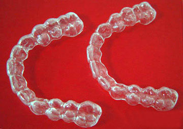 牙齿矫正保持器要制作多久,牙齿矫正后保持器怎么制作