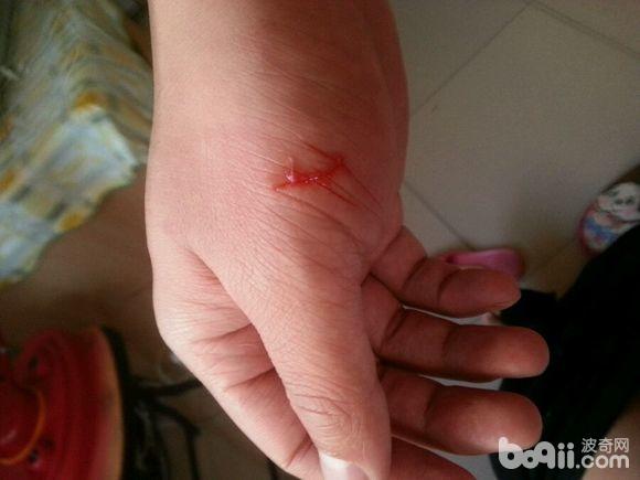 狂犬病可怕还是新冠可怕,狂犬病真的有那么吓人吗