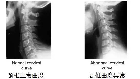 脖子一动就咔咔响很舒服,脖子一动就咔嚓咔嚓响