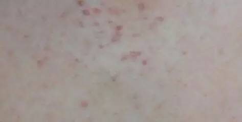 据说大部分的中国人到新加坡之后都有这种“病”！