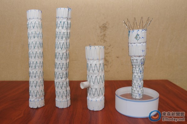 心血管支架多长时间更换,心血管球囊与支架的区别