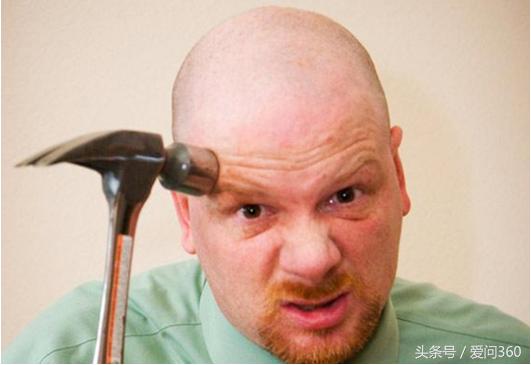 生姜真的可以治疗脱发吗？这些细节要注意