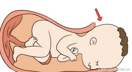生娃顺产好还是剖腹产,生孩子是选择顺产好还是剖腹产好
