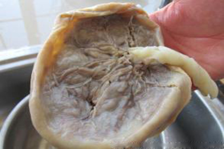 生完孩子胎盘怎么处理好,大家生完宝宝胎盘都怎么处理了