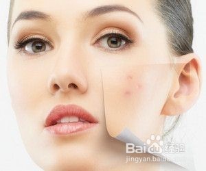 如何有效避免或减少青春痘的出现,避免青春痘误区彻底治疗青春痘