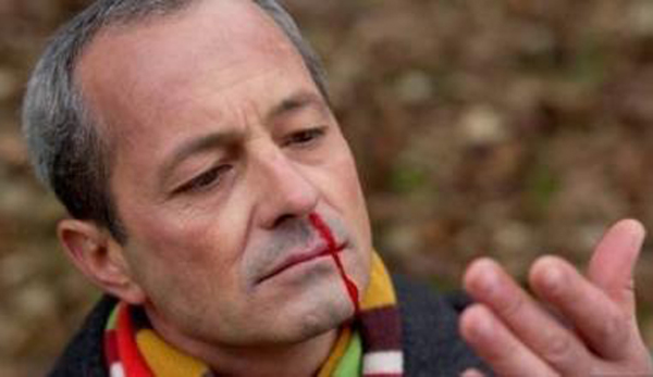 看看你到底有什么病,看看你有没有这些症状