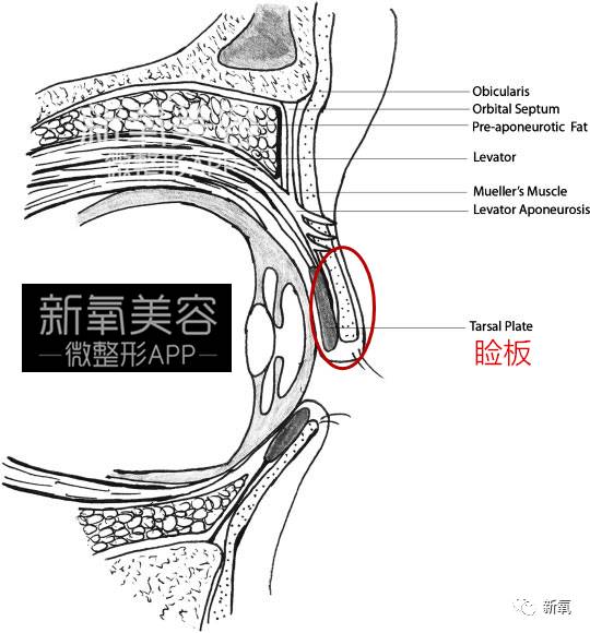 连范冰冰的脸都驾驭不了欧式平行大双，为什么？