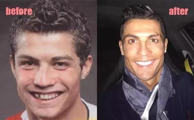 整牙=整容？看杨幂、刘涛、高圆圆为你亲身示范！