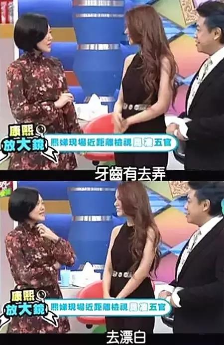 整牙=整容？看杨幂、刘涛、高圆圆为你亲身示范！