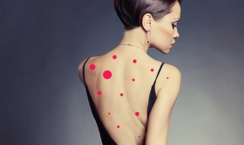 背部长痘的姑娘,后背有痘痘的女生