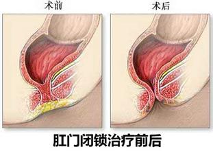 医生开玩笑对怀孕的护士说“你生孩子没*眼屁**！”，没想到一语成谶