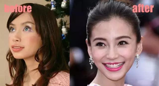 整牙=整容？看杨幂、刘涛、高圆圆为你亲身示范！