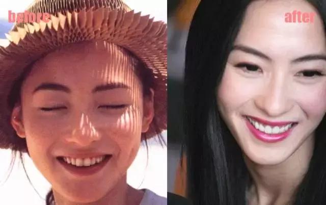 整牙=整容？看杨幂、刘涛、高圆圆为你亲身示范！