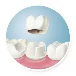 整牙=整容？看杨幂、刘涛、高圆圆为你亲身示范！