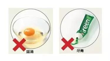 拒绝草莓鼻，如何正确去黑头这些你要知道！