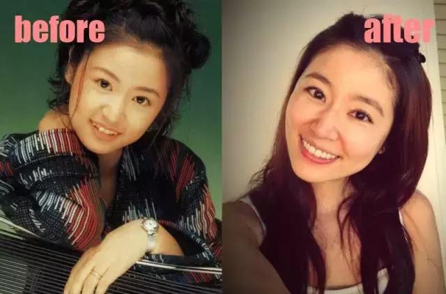 整牙=整容？看杨幂、刘涛、高圆圆为你亲身示范！