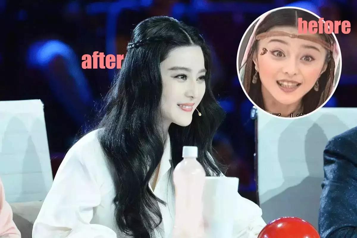 整牙=整容？看杨幂、刘涛、高圆圆为你亲身示范！