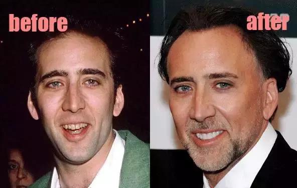 整牙=整容？看杨幂、刘涛、高圆圆为你亲身示范！