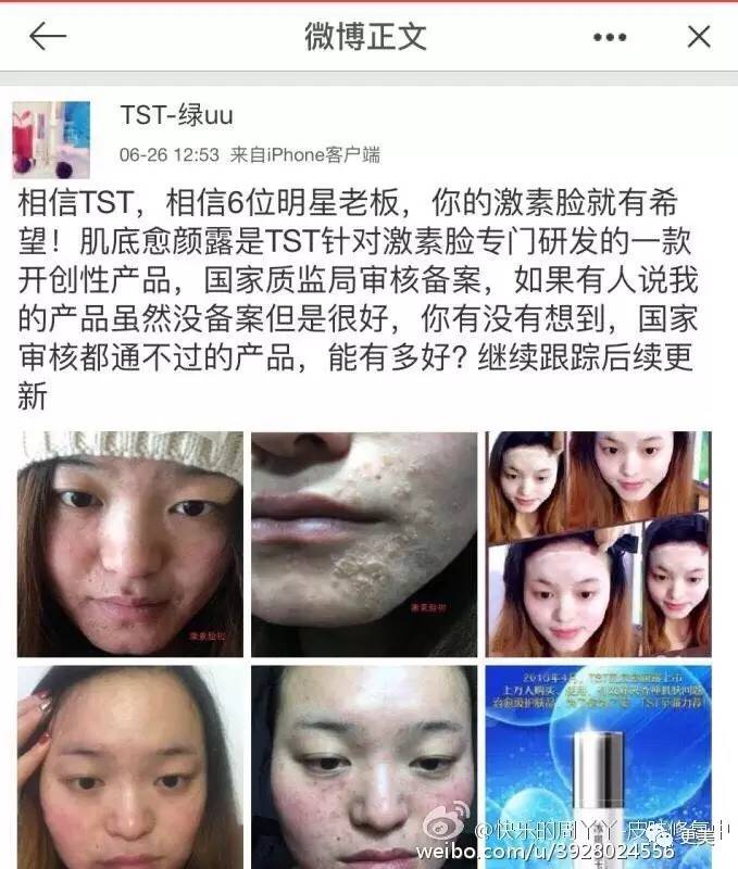 卖劣质面膜的明星,明星卖假化妆品后续