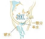 分娩预兆有哪些,啥叫分娩前的预兆