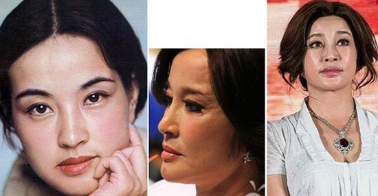 刘晓庆整容前后对比照吓人驻颜有术是骗人的！