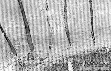 爱美的你不再害怕鱼尾纹,鱼尾纹如何去除不留痕迹