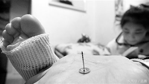 孩子受伤到医院需要打碎伤风吗,破伤风疫苗受伤后多久打有效