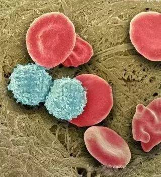 Word天！想不到癌细胞如此惊艳