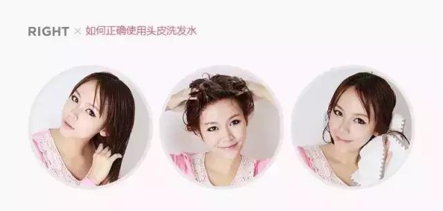发际线两边掉头发用什么洗发水,用什么洗发水防止男生发际线后移