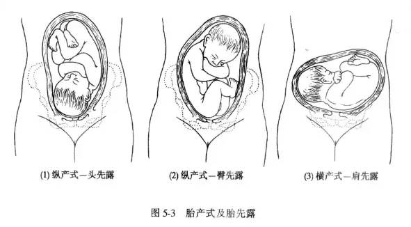 「科普」剖腹产的女明星那么多，为啥瘦小的“教主夫人”（杨颖）却能顺产？