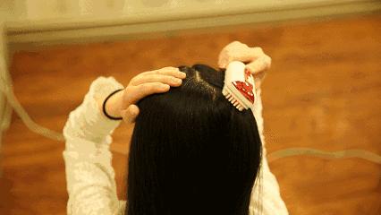 产后脱发想改善学会这2招,涨知识产后脱发的你该如何拯救